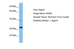 RHCE Antibody, Novus Biologicals 100 &mu;L; Unconjugated:Antibodies, Polyclonal